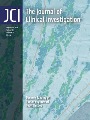 Rapid Measurement of SARS-CoV-2 Spike T Cells in Whole Blood from Vaccinated and Naturally Infected Individuals.